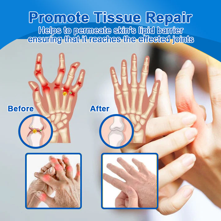 POLARFRESH® Botulinum Toxin & Alpha Lipoic Acid Pain-Relief Neuro-Repair Lotion