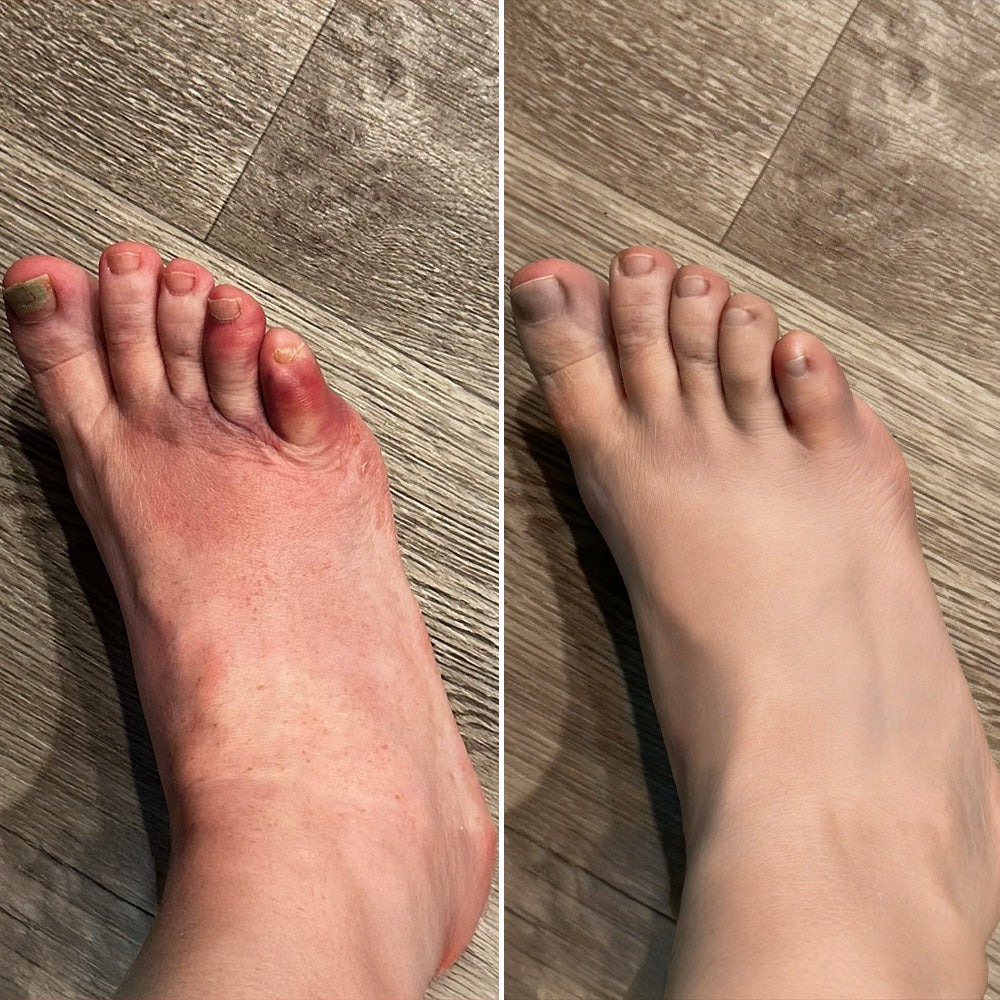 POLARFRESH® Botulinum Toxin & Alpha Lipoic Acid Pain-Relief Neuro-Repair Lotion