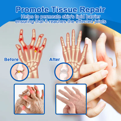 POLARFRESH® Botulinum Toxin & Alpha Lipoic Acid Pain-Relief Neuro-Repair Lotion