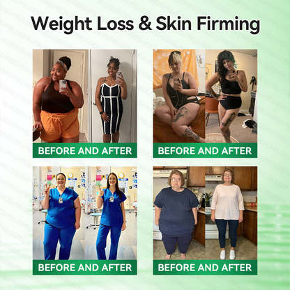 𝐂𝐚𝐫𝐞𝐔𝐩𝐥𝐢𝐟𝐭® 𝑴𝒐𝒓𝒊𝒏𝒈𝗮 · 𝗕𝗲𝗿𝗯𝗲𝗿𝙞𝙣𝙚×𝙉𝘼𝐃+ 𝟏𝟎-𝐢𝐧-𝟏 𝗔𝗱𝘃𝗮𝗻𝗰𝙚𝙙 𝙉𝙖𝙣𝙤 𝙈𝙞𝙘𝙧𝙤𝙣𝙚𝙚𝐝𝐥𝐞 𝐏𝐚𝐭𝙘𝙝🇺🇸(𝐉𝐮𝐬𝐭 𝐨𝐧𝐜𝐞 𝐚 𝐝𝐚𝐲,𝐯𝐢𝐬𝐢𝐛𝐥𝐞 𝐜𝐡𝐚𝐧𝐠𝐞𝐬 𝐢𝐧 𝟕 𝐝𝐚𝐲𝐬）✅𝐅𝐨𝐫 𝐨𝐛𝐞𝐬𝐢𝐭𝐲,🅛🅞🅞🅢🅔 🅢🅚🅘🅝,𝐝𝐢𝐚𝐛𝐞𝐭𝐞𝐬,𝐬𝐥𝐞𝐞𝐩 𝐚𝐩𝐧𝐞𝐚,𝐣𝐨𝐢𝐧𝐭 𝐢𝐬𝐬𝐮𝐞𝐬,𝐚𝐧𝐝 𝐦𝐨𝐫𝐞