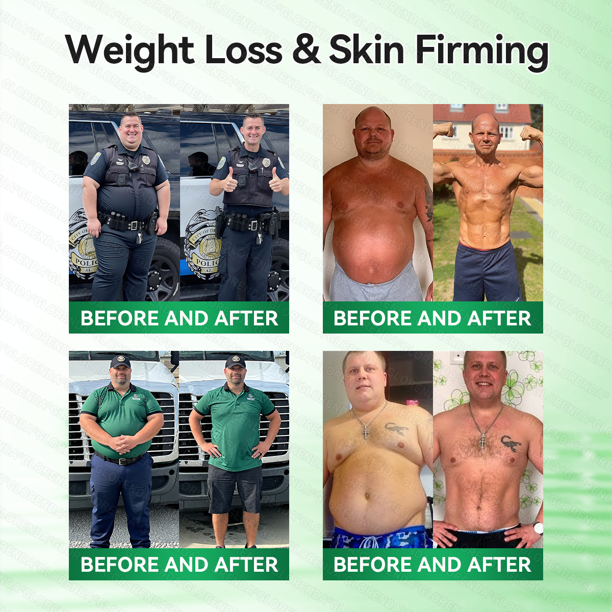 𝐂𝐚𝐫𝐞𝐔𝐩𝐥𝐢𝐟𝐭® 𝑴𝒐𝒓𝒊𝒏𝒈𝗮 · 𝗕𝗲𝗿𝗯𝗲𝗿𝙞𝙣𝙚×𝙉𝘼𝐃+ 𝟏𝟎-𝐢𝐧-𝟏 𝗔𝗱𝘃𝗮𝗻𝗰𝙚𝙙 𝙉𝙖𝙣𝙤 𝙈𝙞𝙘𝙧𝙤𝙣𝙚𝙚𝐝𝐥𝐞 𝐏𝐚𝐭𝙘𝙝🇺🇸(𝐉𝐮𝐬𝐭 𝐨𝐧𝐜𝐞 𝐚 𝐝𝐚𝐲,𝐯𝐢𝐬𝐢𝐛𝐥𝐞 𝐜𝐡𝐚𝐧𝐠𝐞𝐬 𝐢𝐧 𝟕 𝐝𝐚𝐲𝐬）✅𝐅𝐨𝐫 𝐨𝐛𝐞𝐬𝐢𝐭𝐲,🅛🅞🅞🅢🅔 🅢🅚🅘🅝,𝐝𝐢𝐚𝐛𝐞𝐭𝐞𝐬,𝐬𝐥𝐞𝐞𝐩 𝐚𝐩𝐧𝐞𝐚,𝐣𝐨𝐢𝐧𝐭 𝐢𝐬𝐬𝐮𝐞𝐬,𝐚𝐧𝐝 𝐦𝐨𝐫𝐞