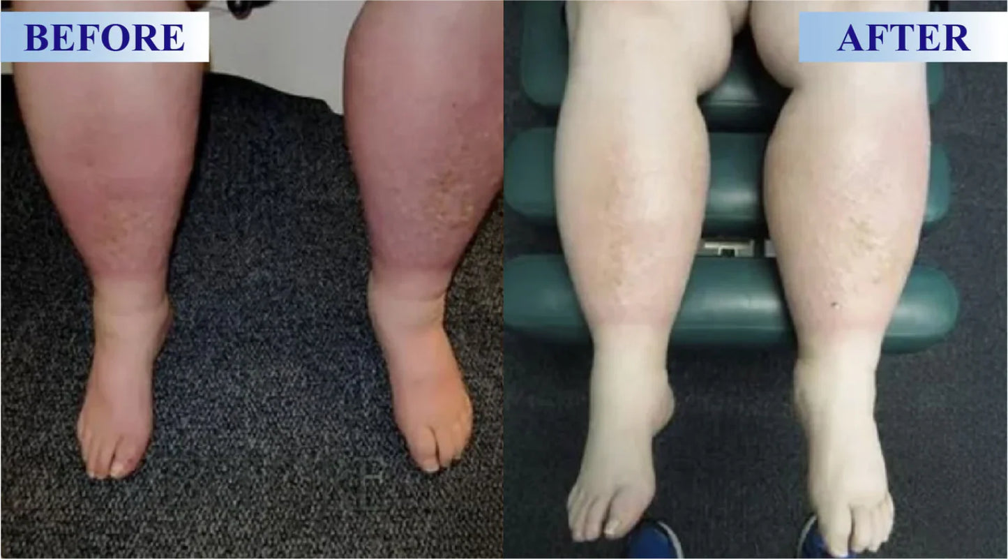 POLARFRESH® Botulinum Toxin & Alpha Lipoic Acid Pain-Relief Neuro-Repair Lotion