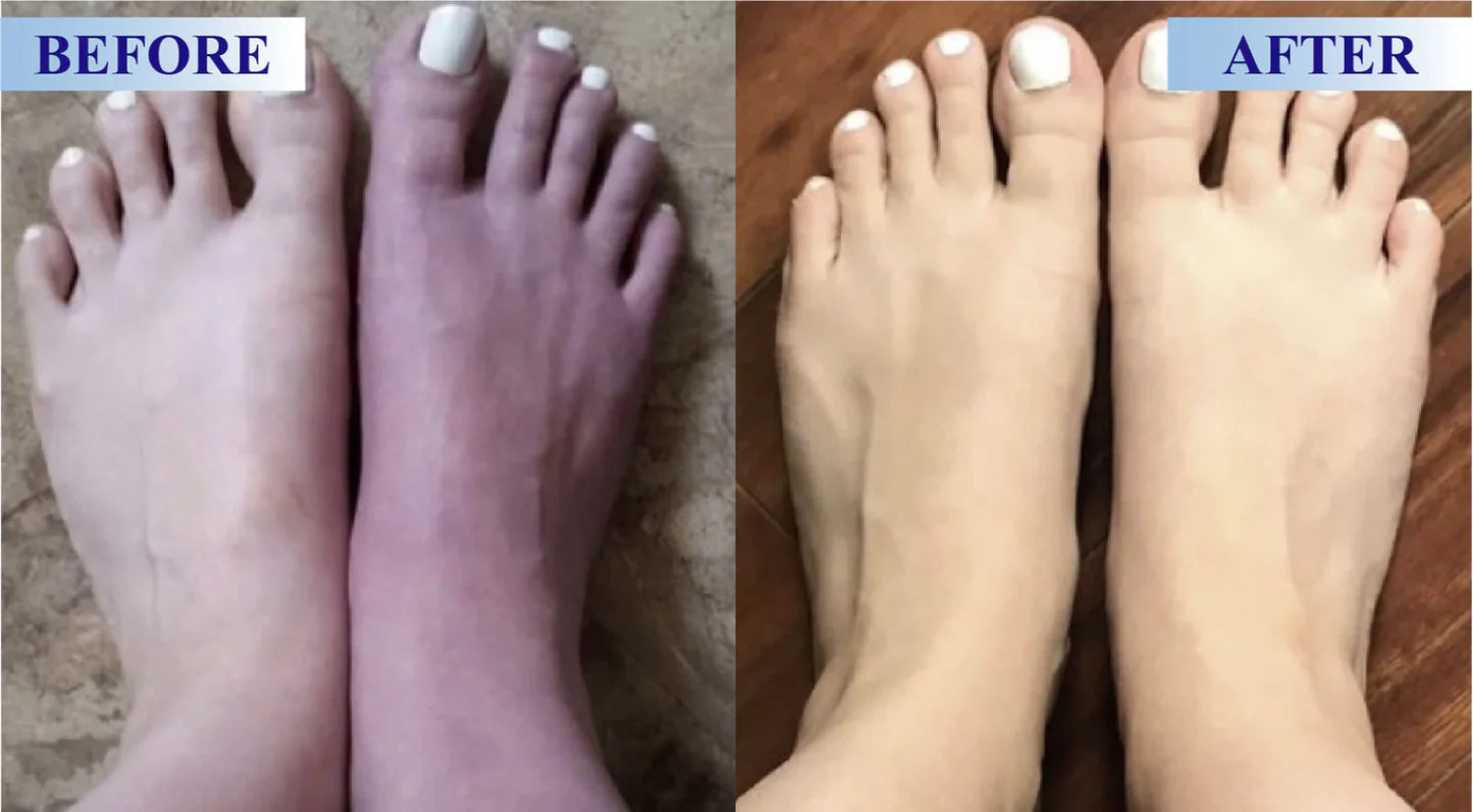 POLARFRESH® Botulinum Toxin & Alpha Lipoic Acid Pain-Relief Neuro-Repair Lotion