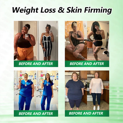 𝑪𝒂𝒓𝒆𝑼𝒑𝒍𝒊𝒇𝒕® 𝗠𝗼𝗿𝗶𝗻𝗴𝗮 · 𝗕𝗲𝗿𝗯𝗲𝗿𝗶𝗻𝗲 × 𝗡𝗔𝗗+ 𝟏𝟎-𝐢𝐧-𝟏 𝐀𝐝𝐯𝐚𝐧𝐜𝐞𝐝 𝐍𝐚𝐧𝐨 𝐌𝐢𝐜𝐫𝐨𝐧𝐞𝐞𝐝𝐥𝐞 𝐏𝐚𝐭𝐜𝐡 — 𝙾𝚗𝚌𝚎 𝙳𝚊𝚒𝚕𝚢, 𝚅𝚒𝚜𝚒𝚋𝚕𝚎 𝚁𝚎𝚜𝚞𝚕𝚝𝚜 𝚒𝚗 𝟽 𝙳𝚊𝚢𝚜✅ ғᴏʀ ᴏʙᴇsɪᴛʏ, ʟᴏᴏsᴇ sᴋɪɴ, ᴅɪᴀʙᴇᴛᴇs, sʟᴇᴇᴘ ᴀᴘɴᴇᴀ, ᴊᴏɪɴᴛ ɪssᴜᴇs, ᴀɴᴅ ᴍᴏʀᴇ