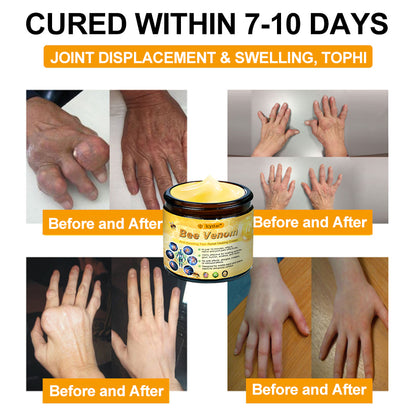 LCYSTAR® Bee Venom Anti-Swelling Pain Relief Healing Cream
