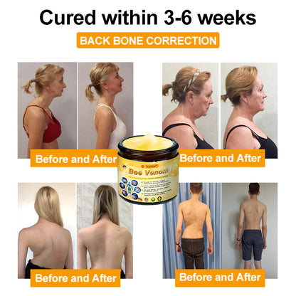 LCYSTAR® Bee Venom Anti-Swelling Pain Relief Healing Cream