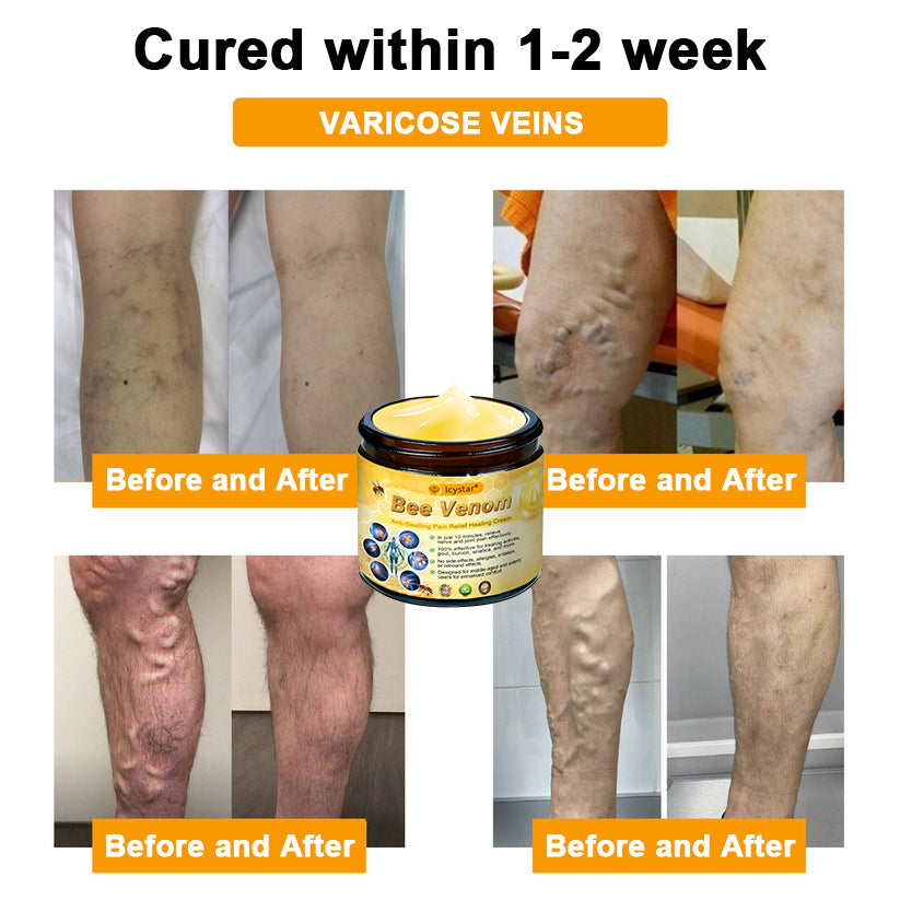 LCYSTAR® Bee Venom Anti-Swelling Pain Relief Healing Cream