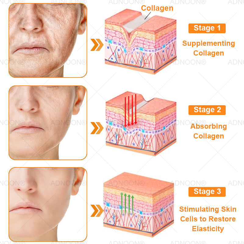 ADNOON® 7 Day Quick Skin Repair Cream-Relieves Scars, Acne, Burns, Rashes, Wrinkles & More