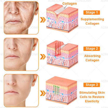 ADNOON® 7 Day Quick Skin Repair Cream-Relieves Scars, Acne, Burns, Rashes, Wrinkles & More