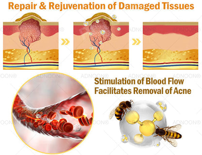 ADNOON® 7 Day Quick Skin Repair Cream-Relieves Scars, Acne, Burns, Rashes, Wrinkles & More