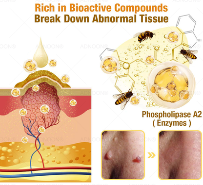 ADNOON® 7 Day Quick Skin Repair Cream-Relieves Scars, Acne, Burns, Rashes, Wrinkles & More